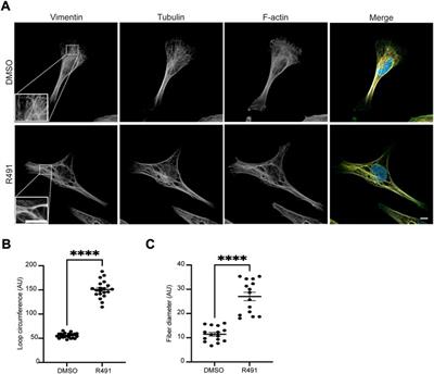 ALD-R491 regulates vimentin filament stability and solubility, cell contractile force, cell migration speed and directionality